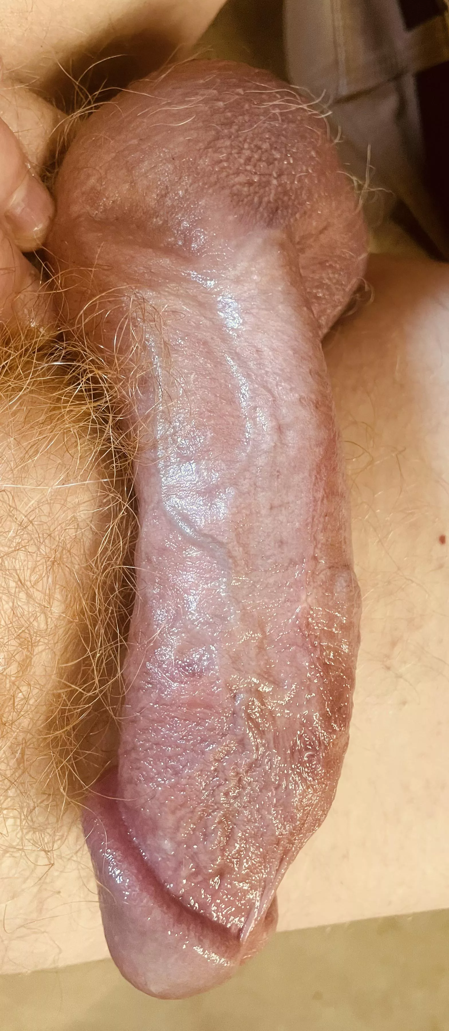 I need relief from the swelling…