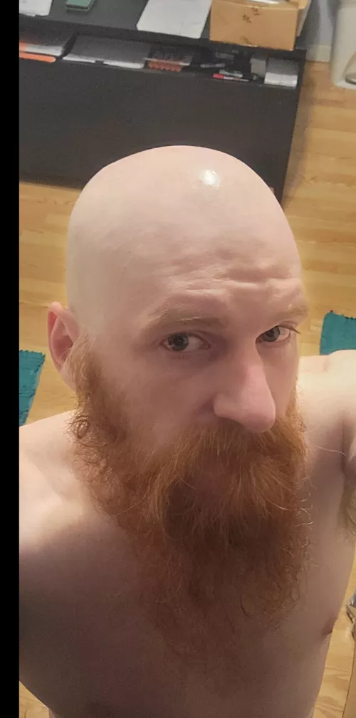 Bald ginger