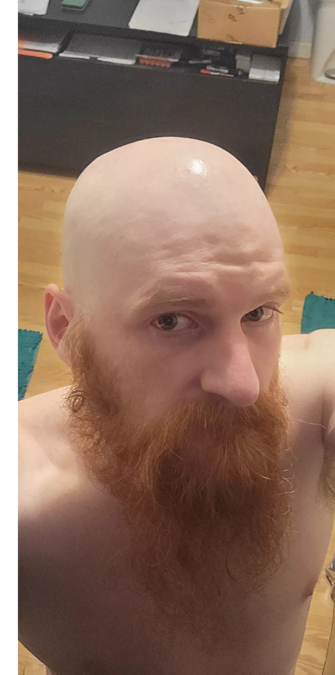 Bald ginger
