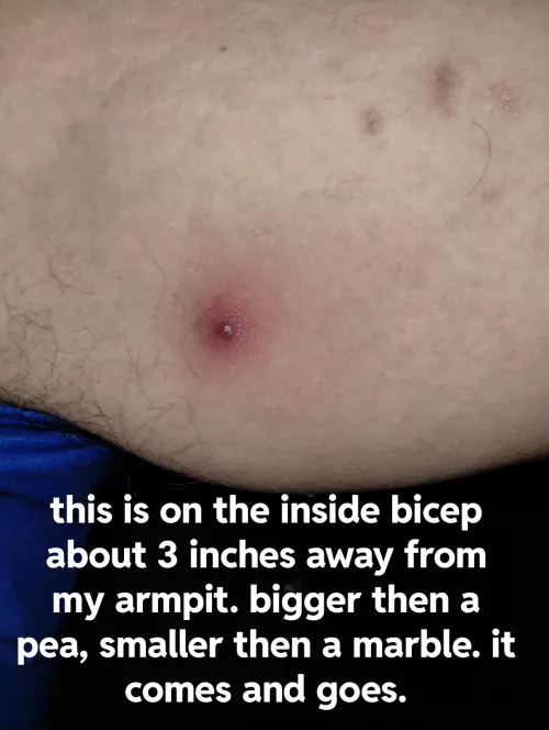 Before I pop what is this ?