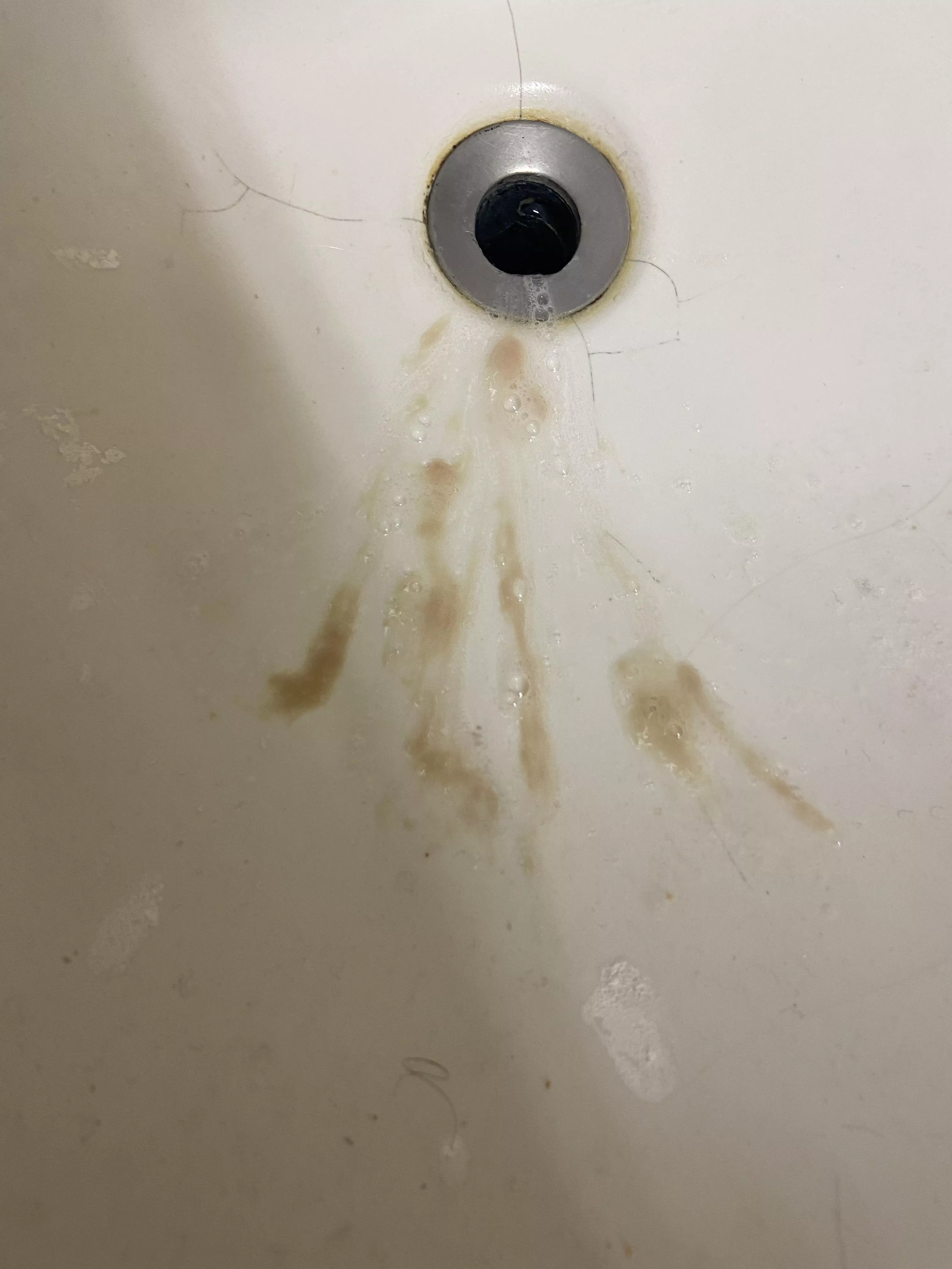 Aftermath of a tonsillar abscess. Was spitting out pus for 20 minutes