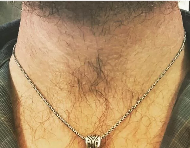 Is it high-growing chest hair or low growing beard hair? 🤣