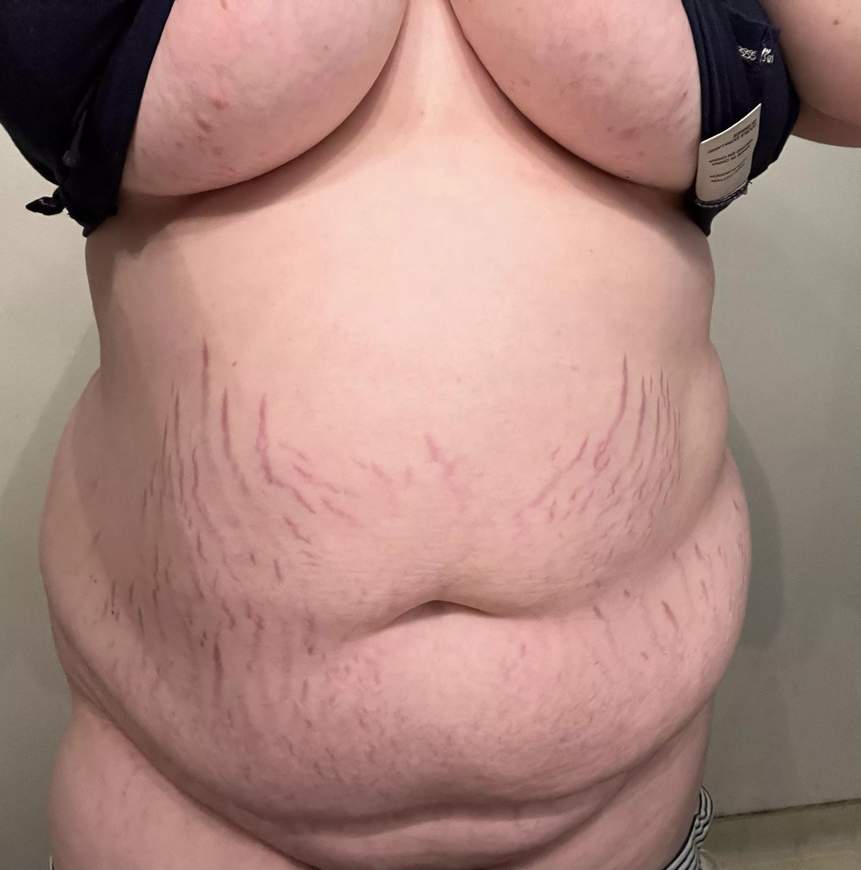 Anyone like stretch marks???