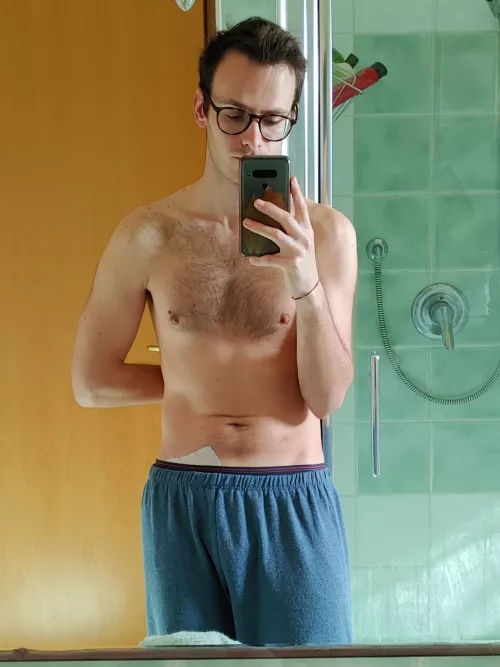 [24] Grumpy face and post-surgery plaster showing, but felt cute nonetheless so here I am, hope you guys will like the pic 🎈