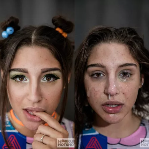 Abella Before vs After