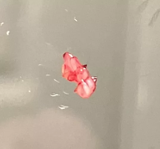 Ahhh relief, came out of “pimple”