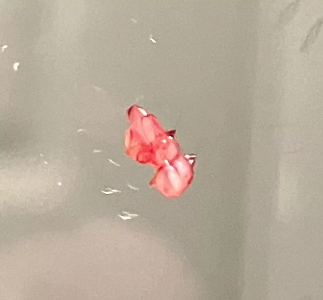 Ahhh relief, came out of “pimple”
