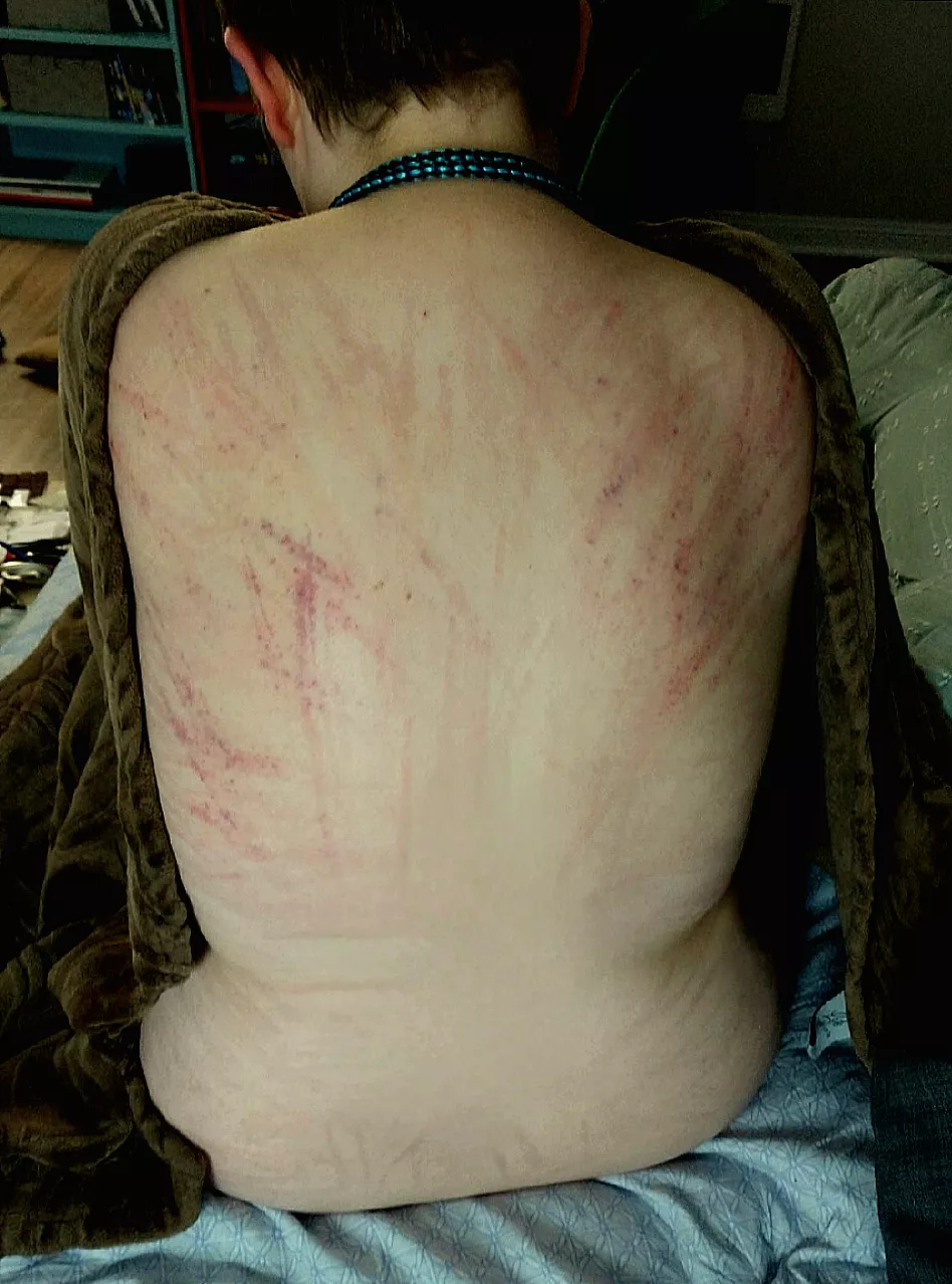 Mark of the Dragon's Tongue