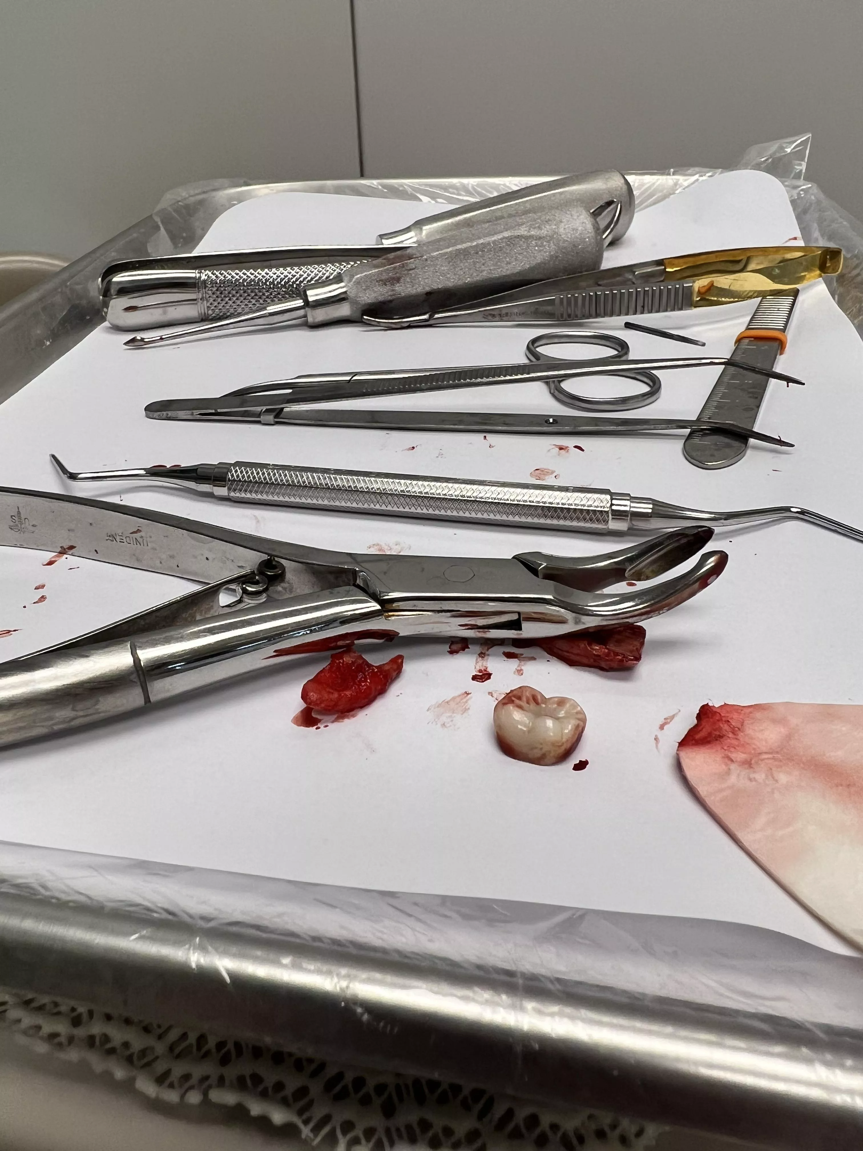 Remains of tooth extraction