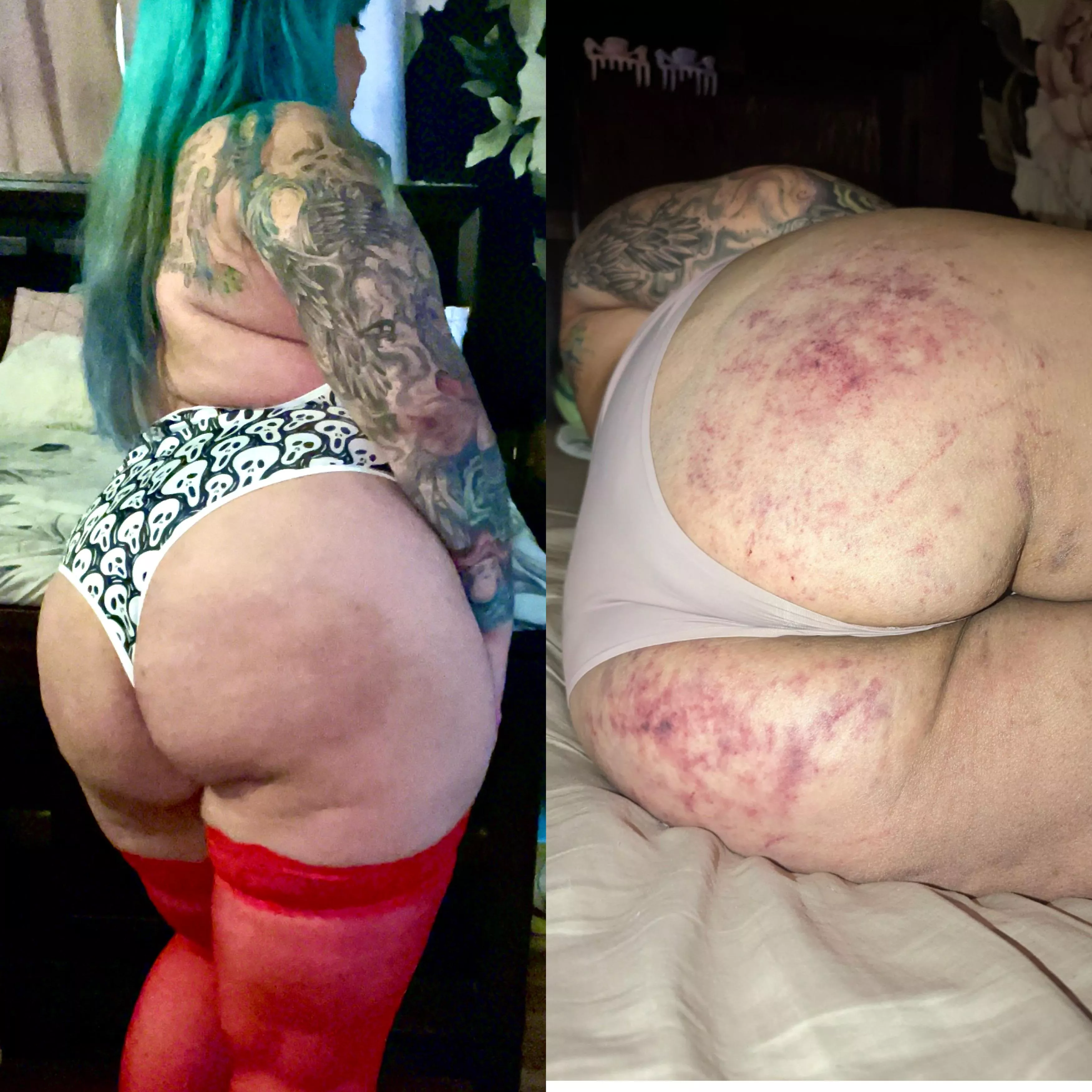 2 weeks later and the marks are almost gone