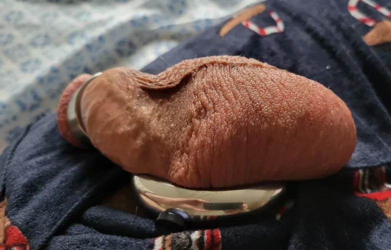 Swollen from edging multiple days