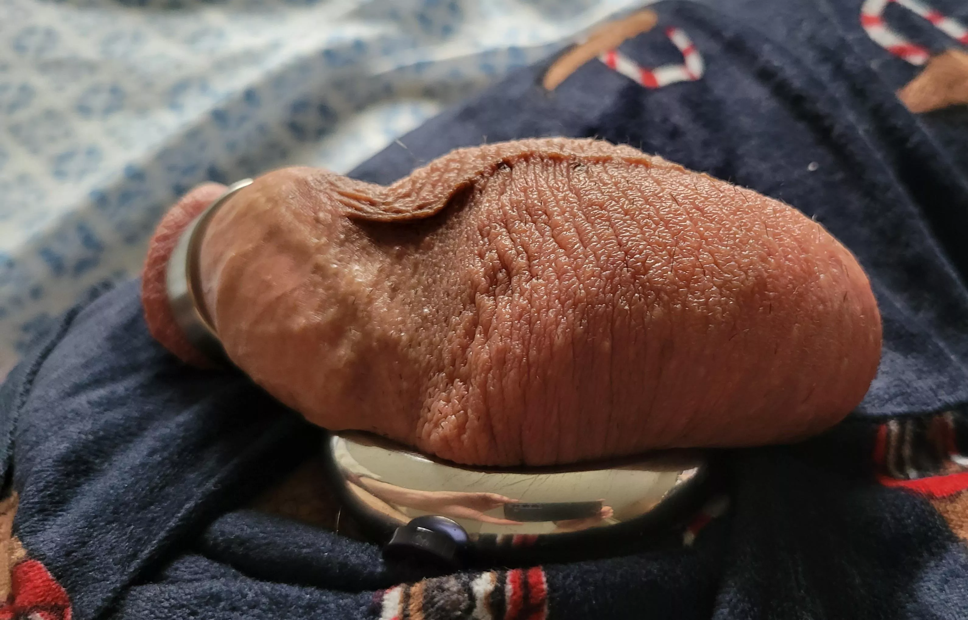 Swollen from edging multiple days