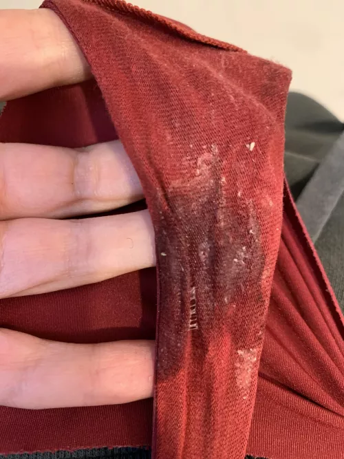 That lil part that’s puss glued together 💓