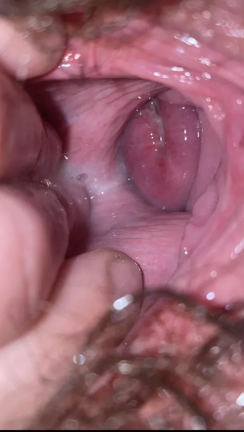 I’ve just started my journey with stretching. As of right now I can get 4 fingers in. I can’t wait to take a fist and even bigger eventually!!!