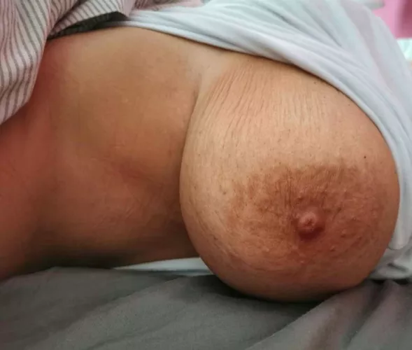 One sagging to the side