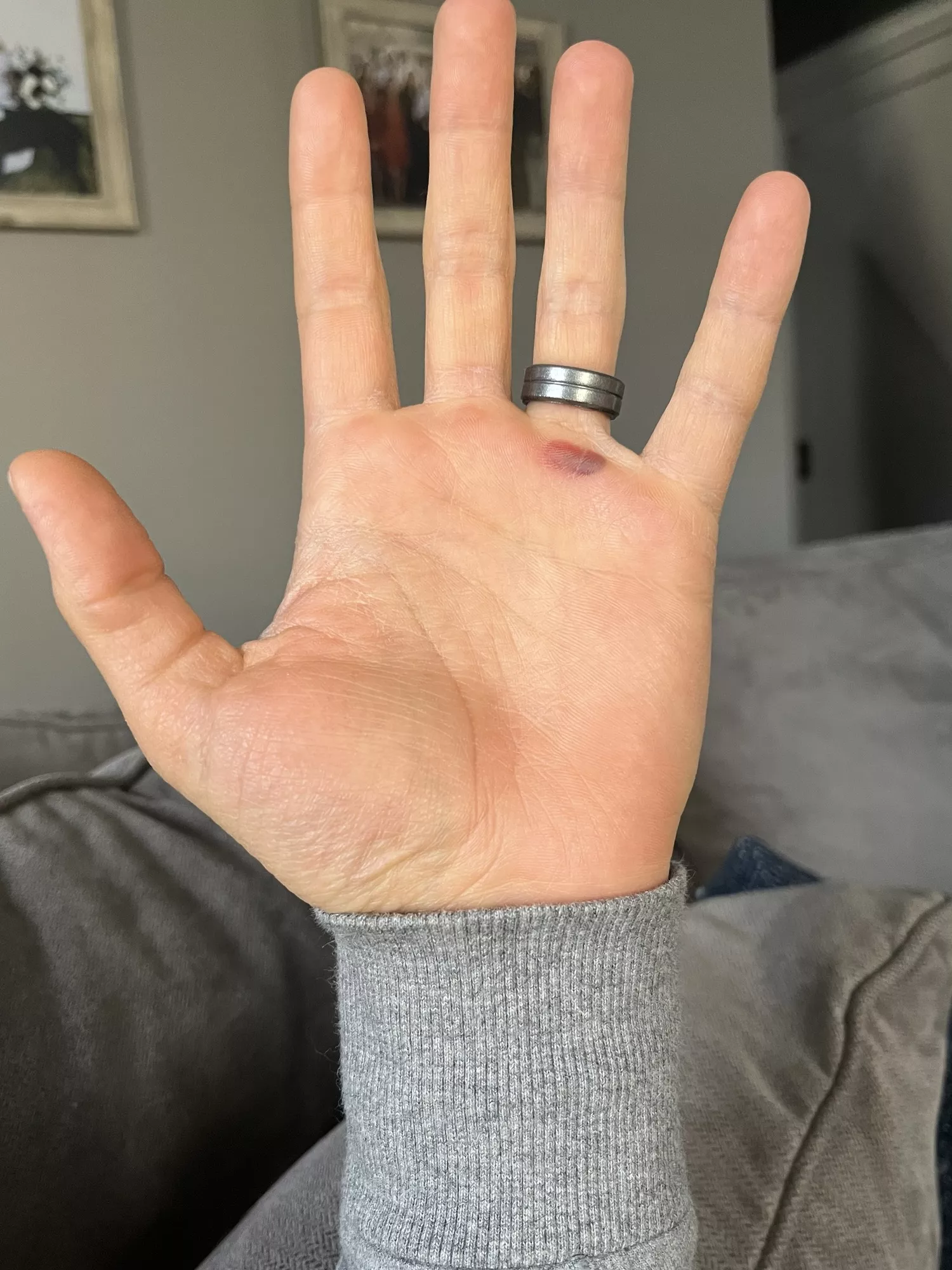 [forbidden pop] I can feel it pulse with every heartbeat