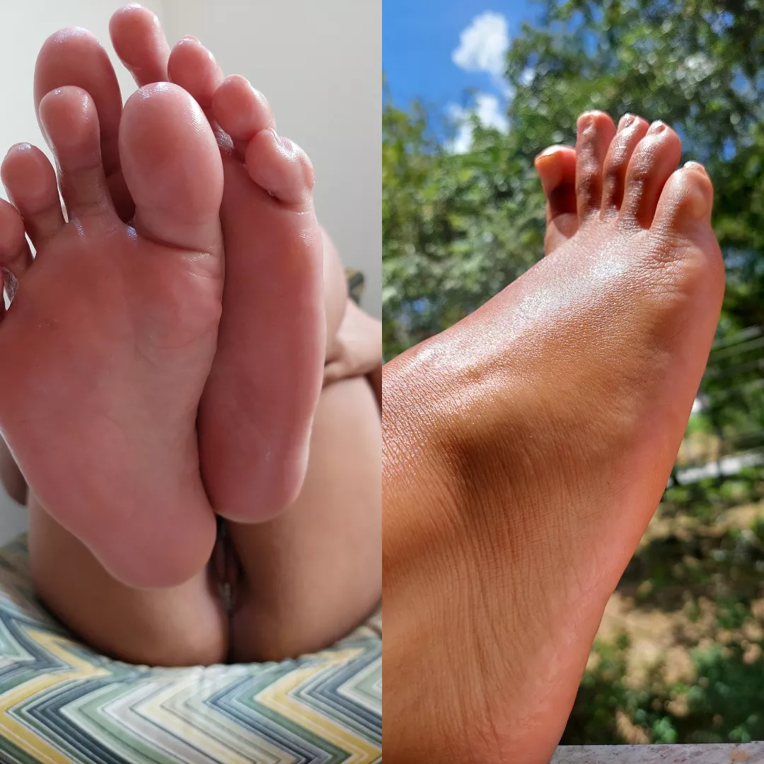 my oily foot