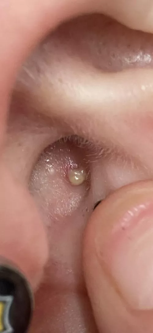 Inner Ear - felt something inside