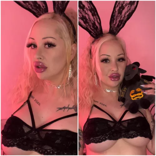 Should I get more lip filler?