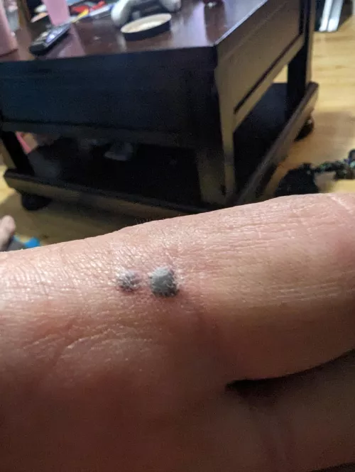 It's not tire season until you get yourself with the weight hammer.