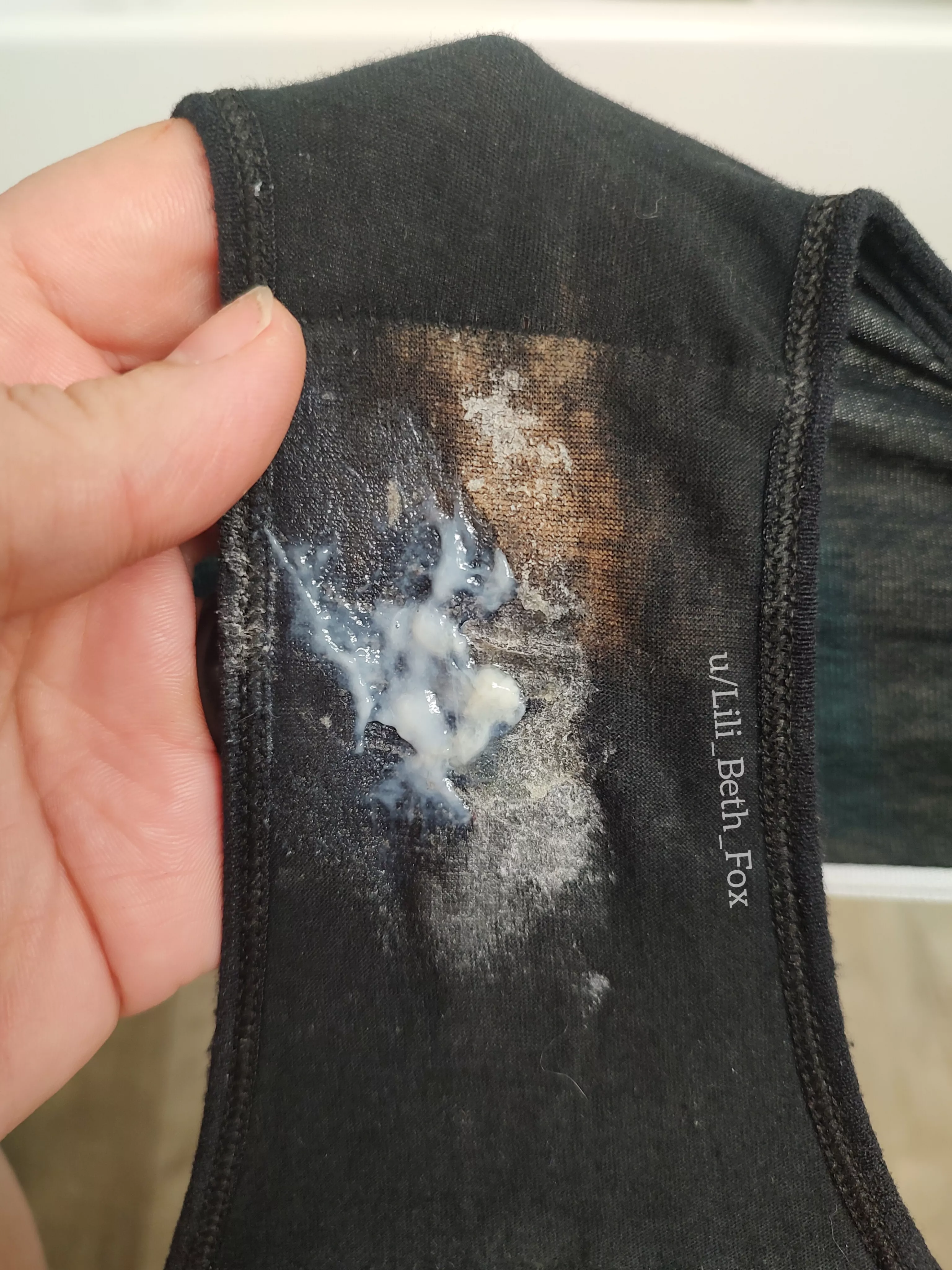 When you have so much fun you bleach the gusset [OC]