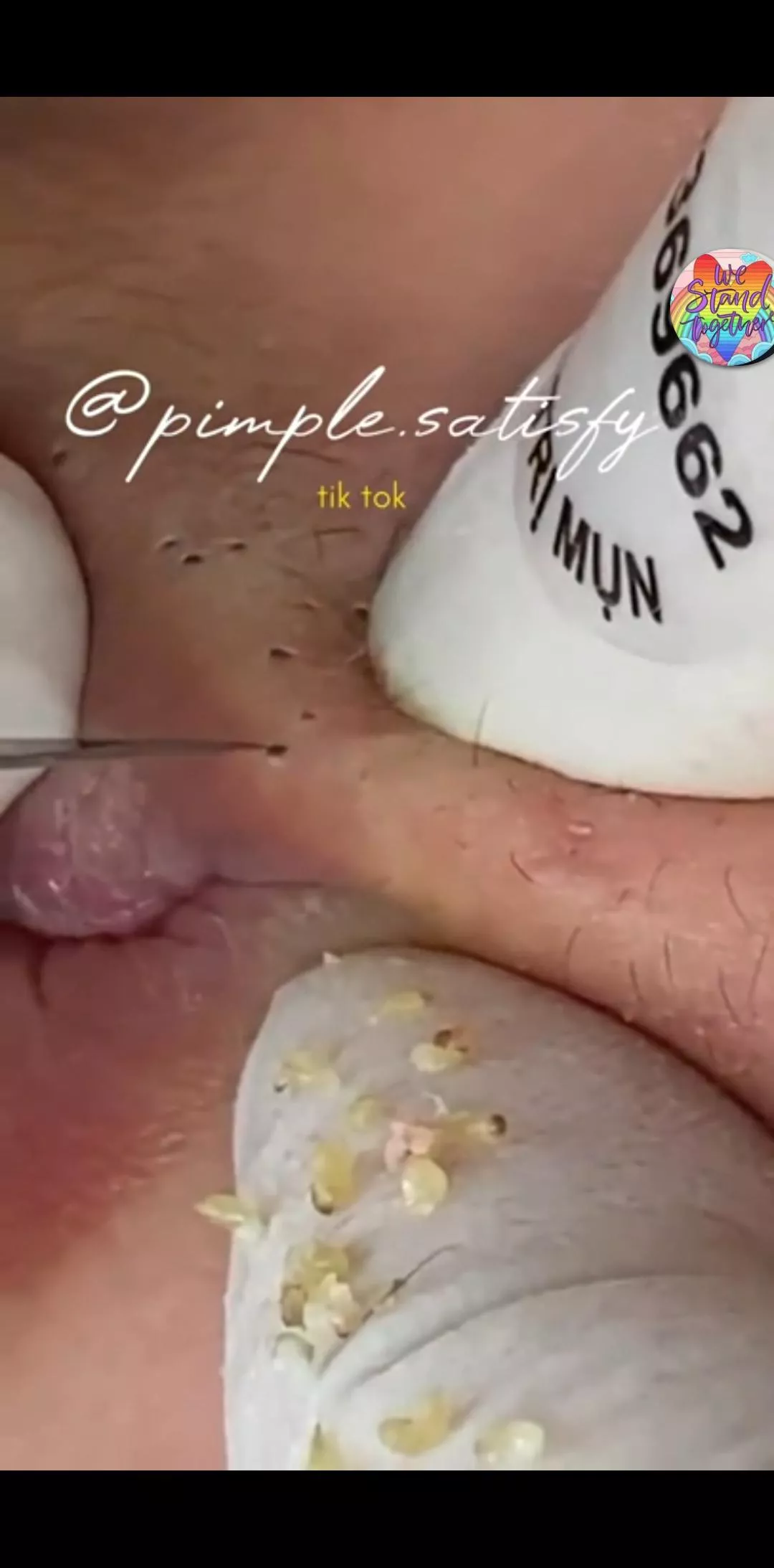 Does anybody actually like it when places wipe all the contents on a glove/gauze or even leave them on the skin so their visible?