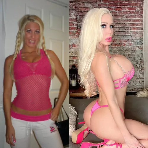 From b cup to DDD 1150cc and now healing from my new 1500cc. Plastic is fantastic