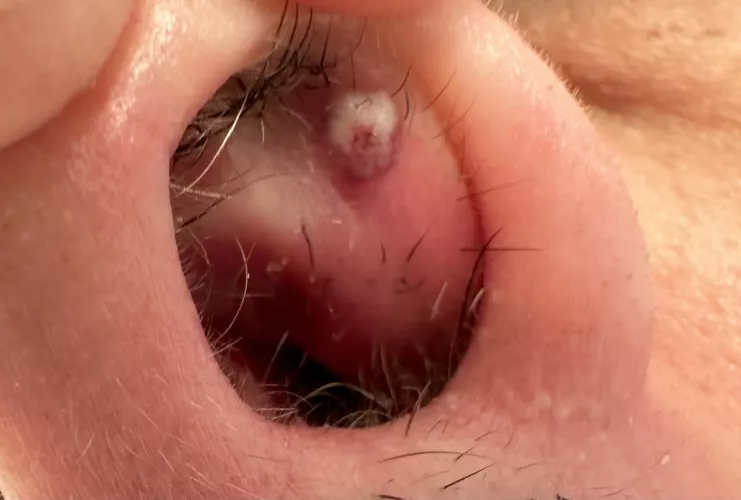 Woke up to this beast in my nostril
