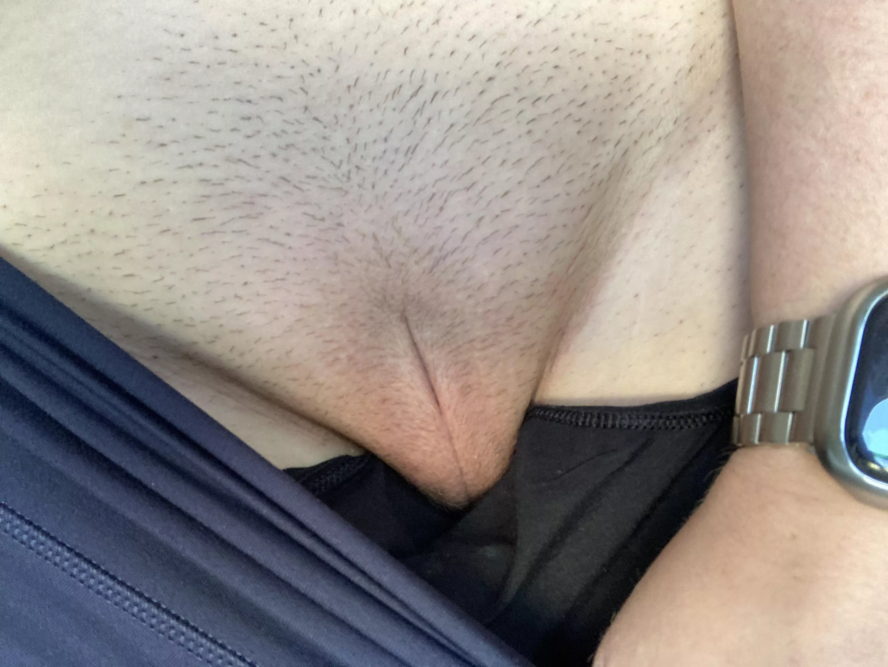 Starting laser hair removal. All of it will be gone! [F38]