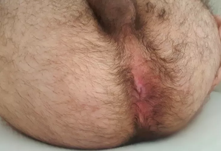 Need a dick so badly, dm me ;)