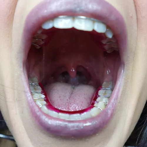 Is my uvula big?