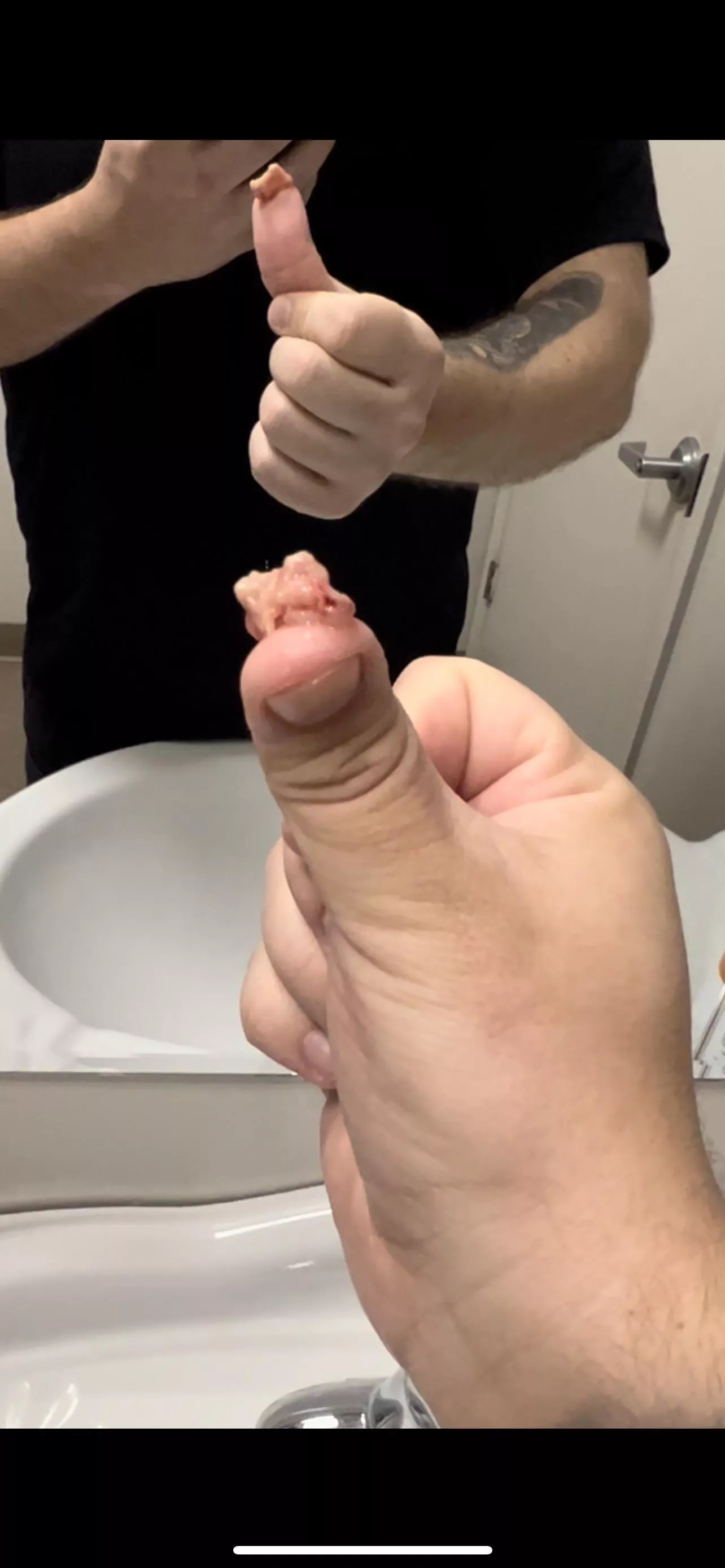 This just came out of my nose and I can finally breathe again after a 3 week sinus infection 👀