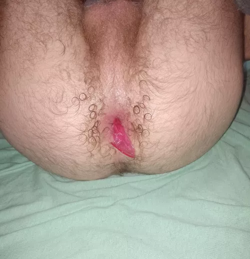 He called me cum dumpster and left the condom inside 🥵♥️