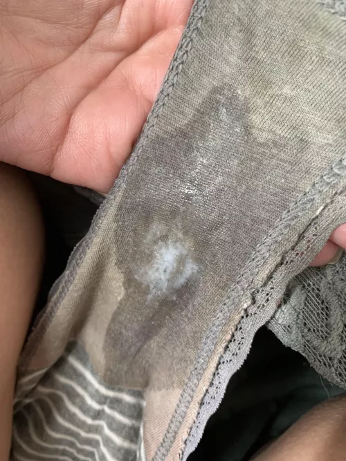 That’s one juicy (not so) lil spot