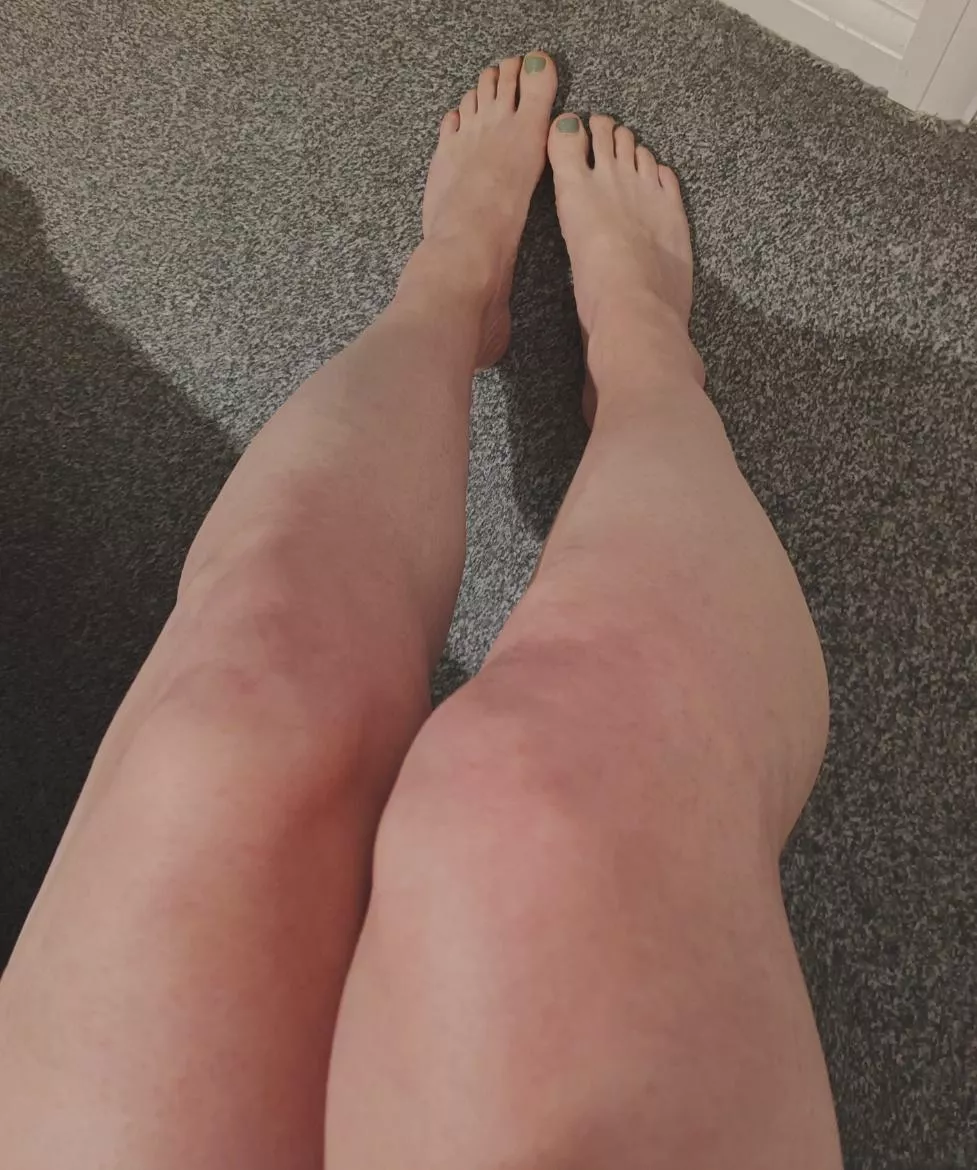 My little legs n feets 🥰