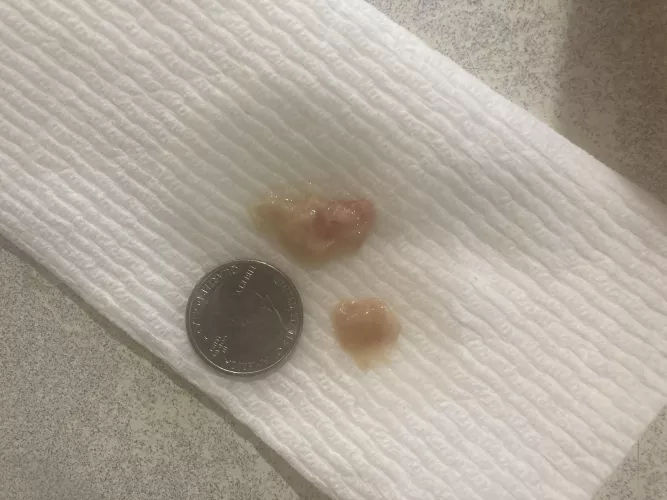 This came out of my sinuses this morning - no clue what it is.
