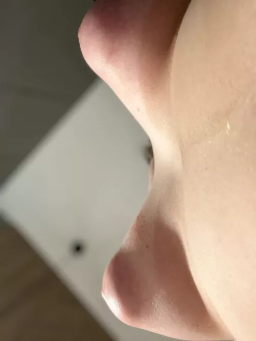 Under side view [Image]