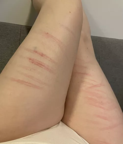 The pleasure you get from pain