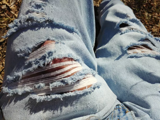 Tiger tan lines! LOL