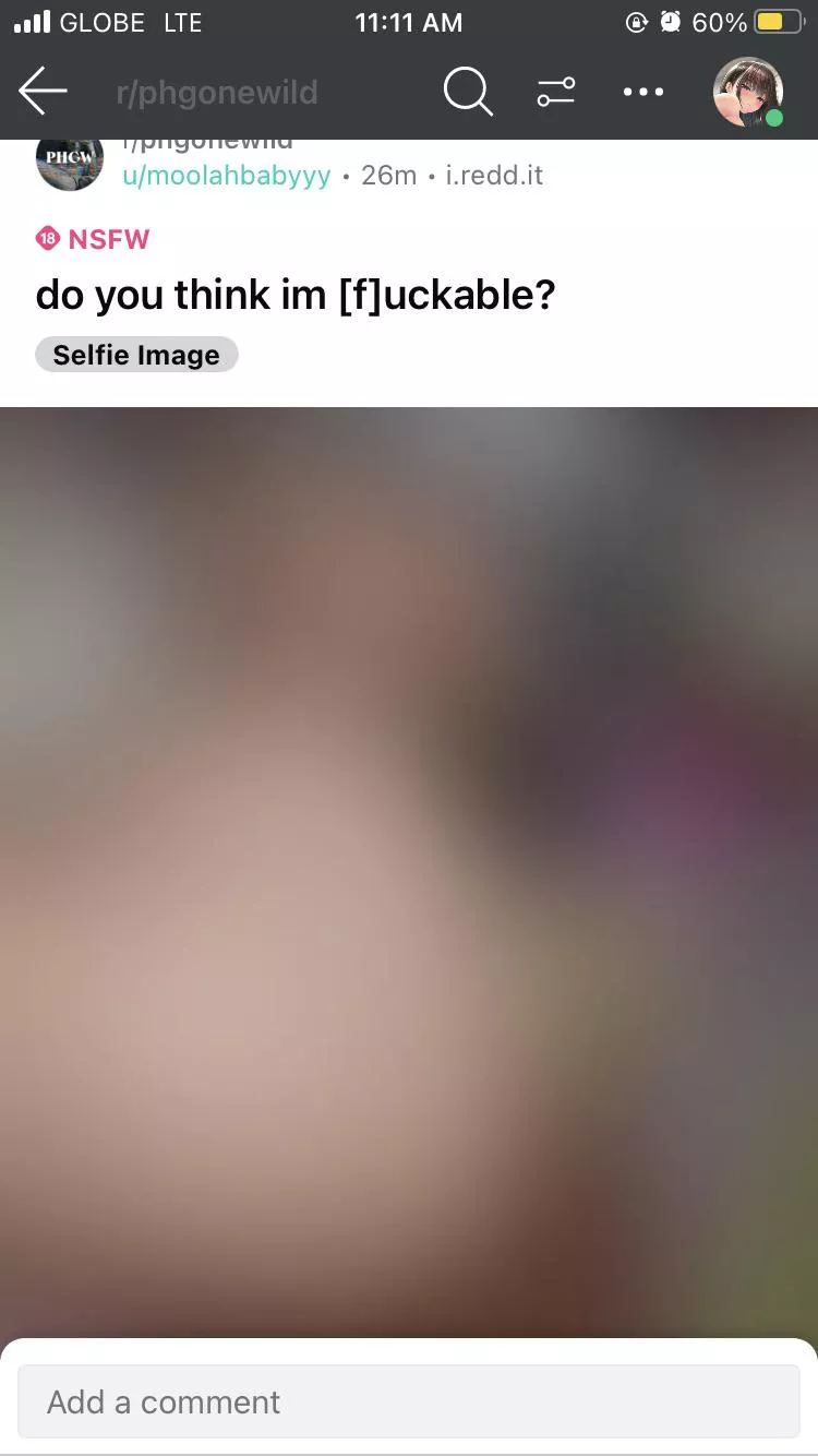 Why does my post [f]rom another account doesn’t get any upvotes? Am i shadowbanned? 😕