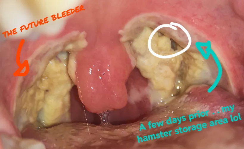 Don't laugh too hard at your own joke, a cautionary tale.