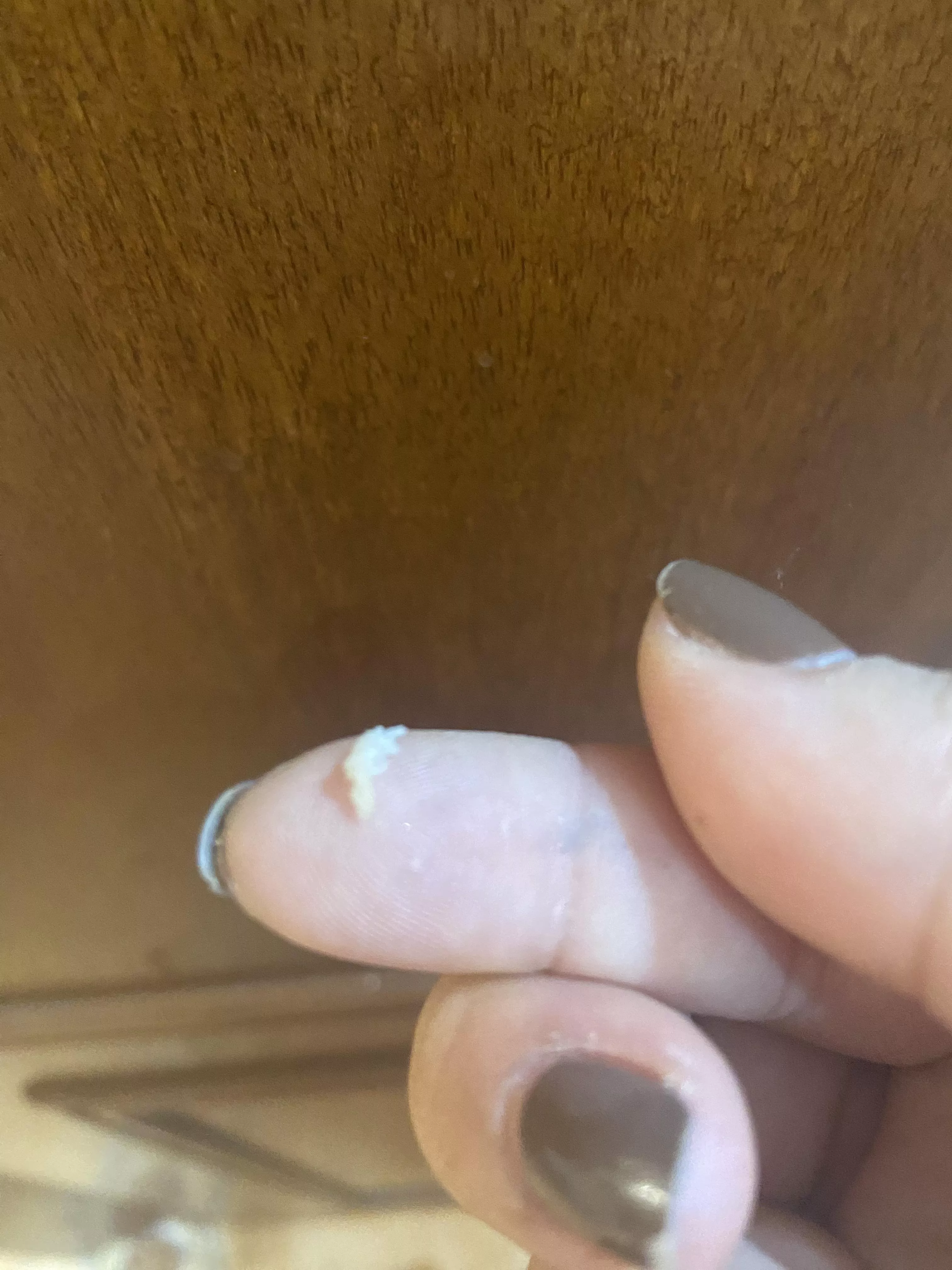 Follow up to my last post. I es making sure I didn’t leave anything in. I think I got it all (a bit more came out, including the sack, I think)