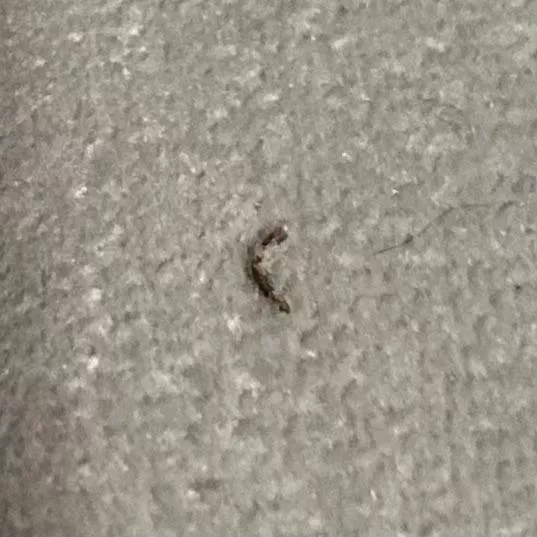 [PIC] i had this annoying thing in my leg for weeks until I decided to try popping it. Sorry for no video