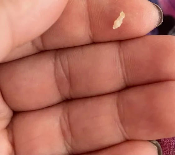 This came out of my scalp