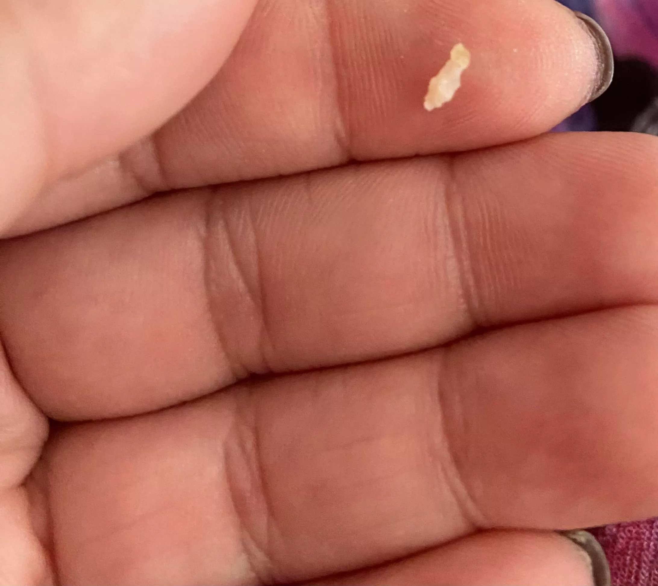 This came out of my scalp