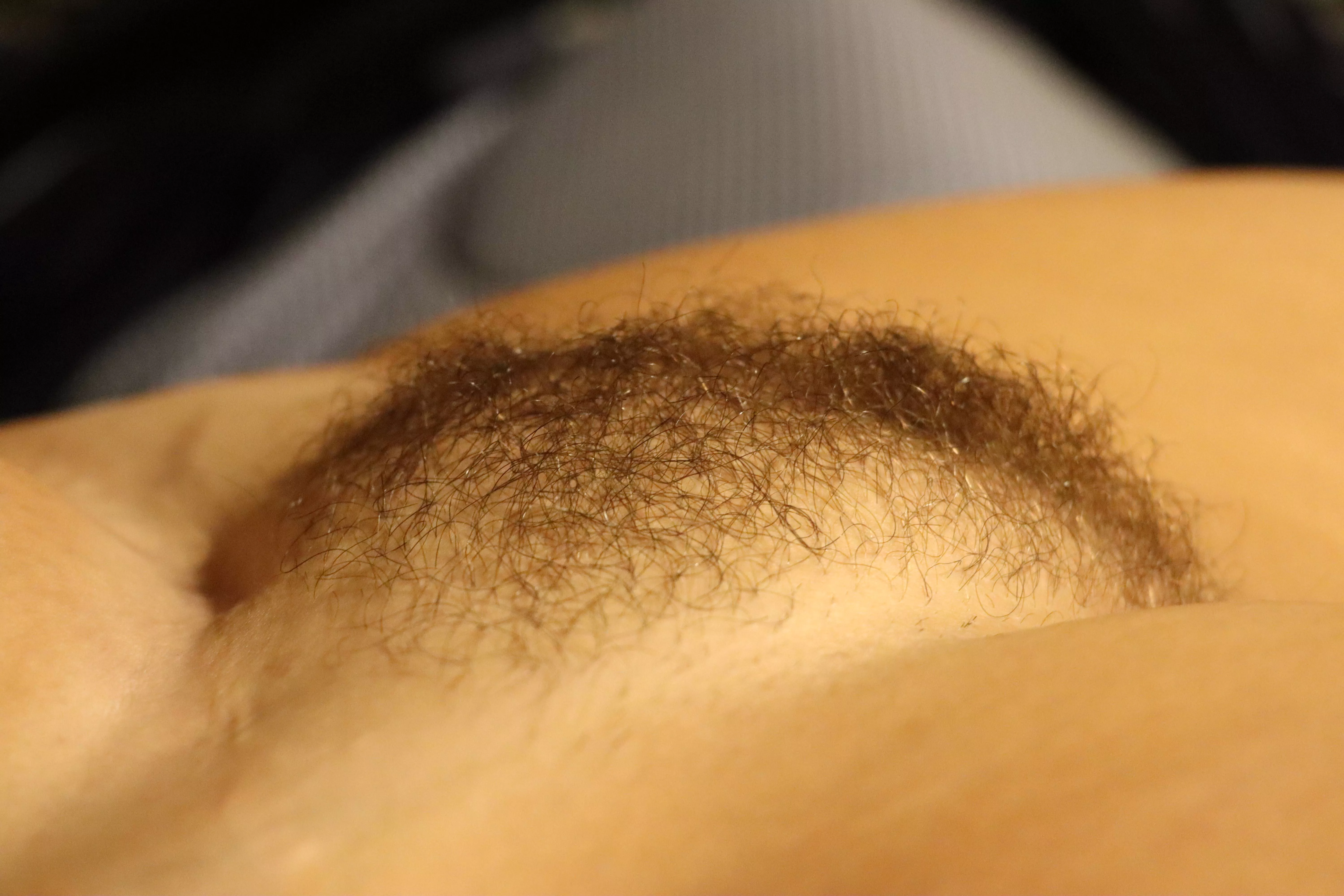 She has gotten fuzzy