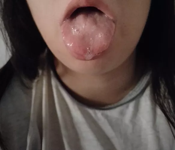 Waiting for my award