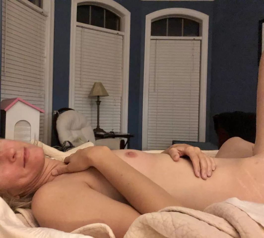 Insecure about stretch marks. Help me out? F 42, 130, 5’6 Insecure about stretch marks. Help me out? F 42, 130, 5’6