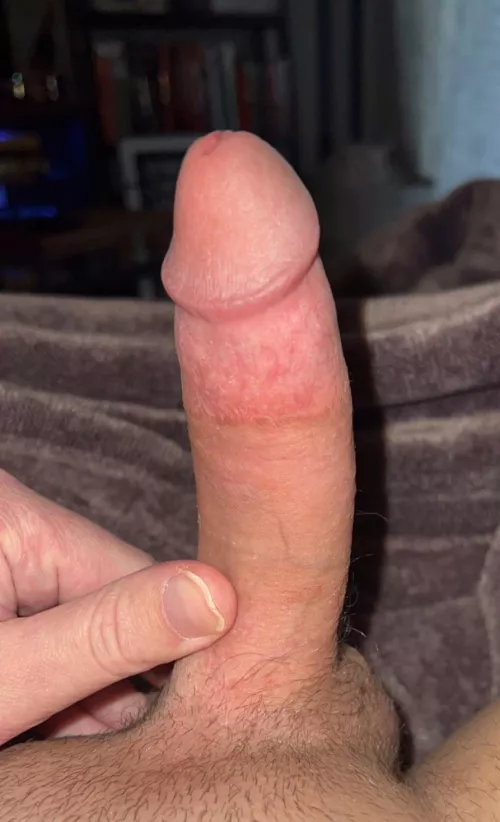 been told that I have Curved Canadian Cock — does it fit here?