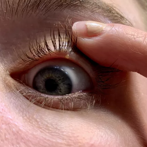 Forbidden pop on the waterline of my eyelid